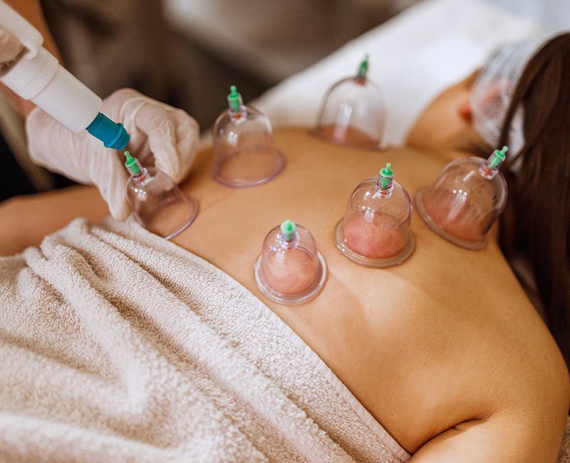Functional Cupping