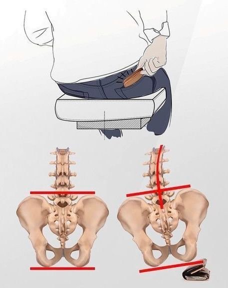 Fat Wallet Syndrome: