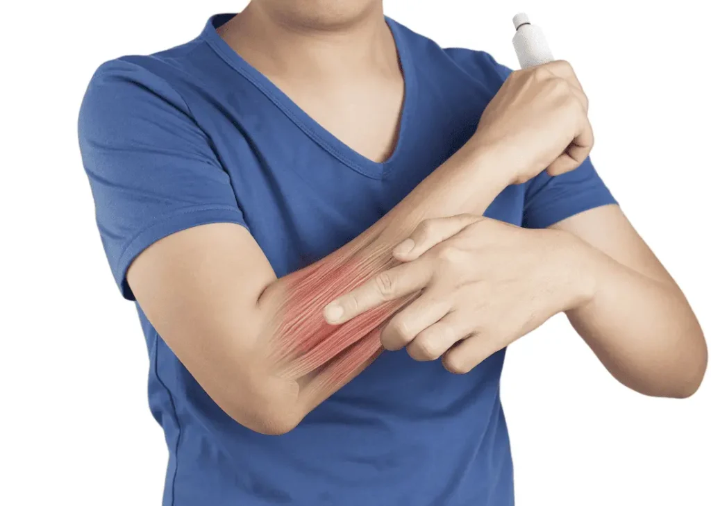 Forearm Flexor Strain