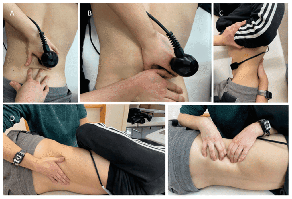 Tecar Therapy