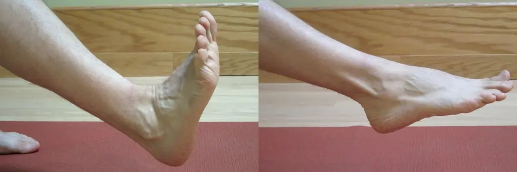 Ankle Sprains