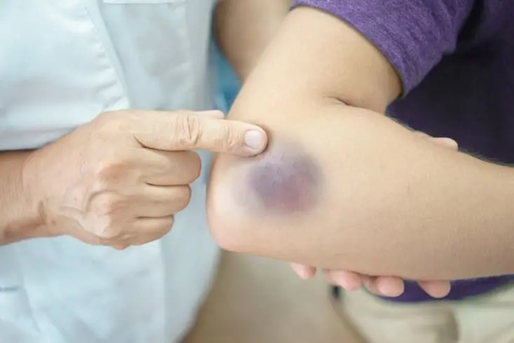 Sports Injuries Treatment