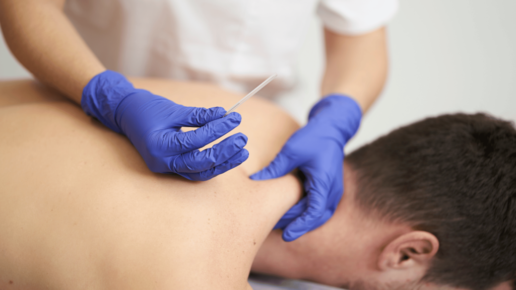 Dry Needling